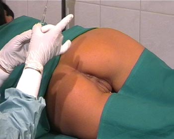 injections ass butt clinic pain nervous