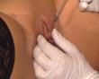 injections clit tits nipples pain torture doctor clinic