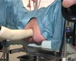 ultraschall sonde anal faust untersuchung klinik