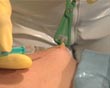 clinic injections needle needles tits nipple into the