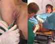 injections pussylips labia horny pain torture painful