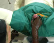 Ballooncatheter catheter stomachsound pee horny