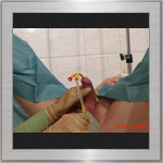 Intensive care - catheter
